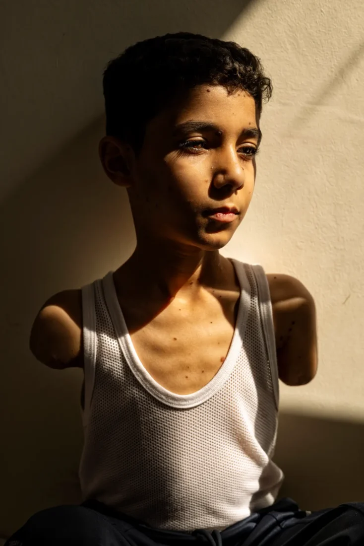 Samar Abu Elouf wins 2025 World Press Photo for haunting image of Gazan child survivor