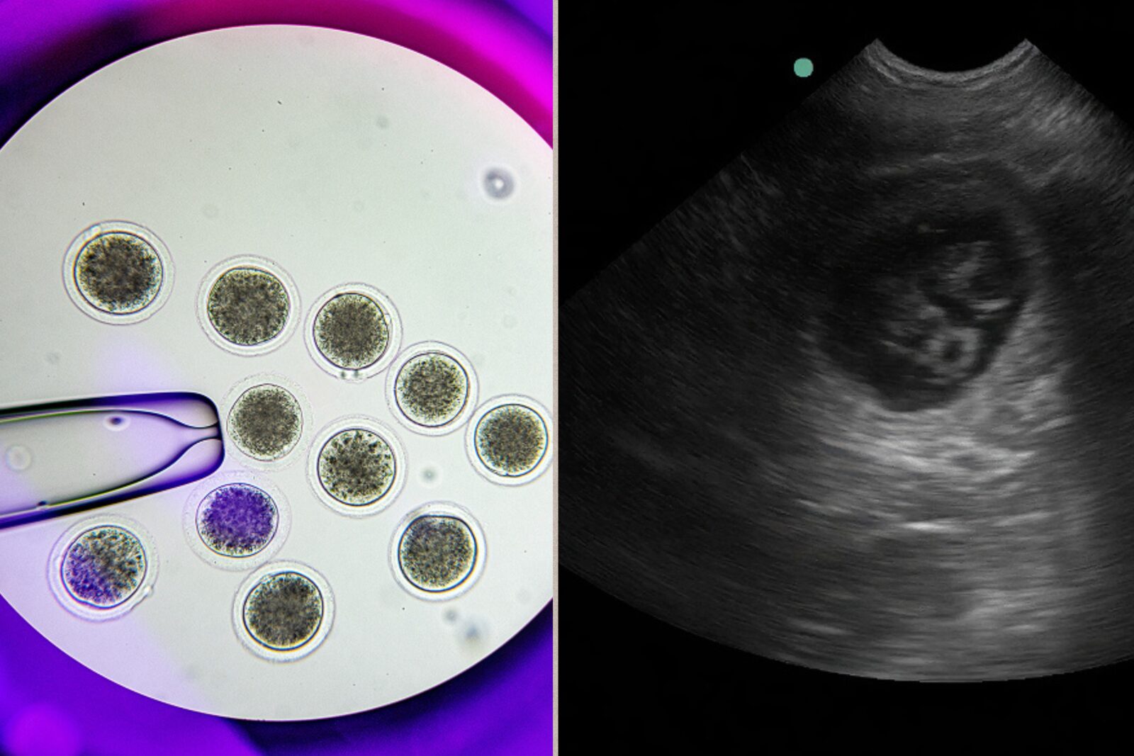 Embryo image (Left) and ultrasound image (Right) 